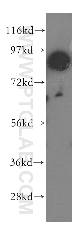 Western Blot (WB) analysis of PC-3 cells using RNF10 Polyclonal antibody (16936-1-AP)