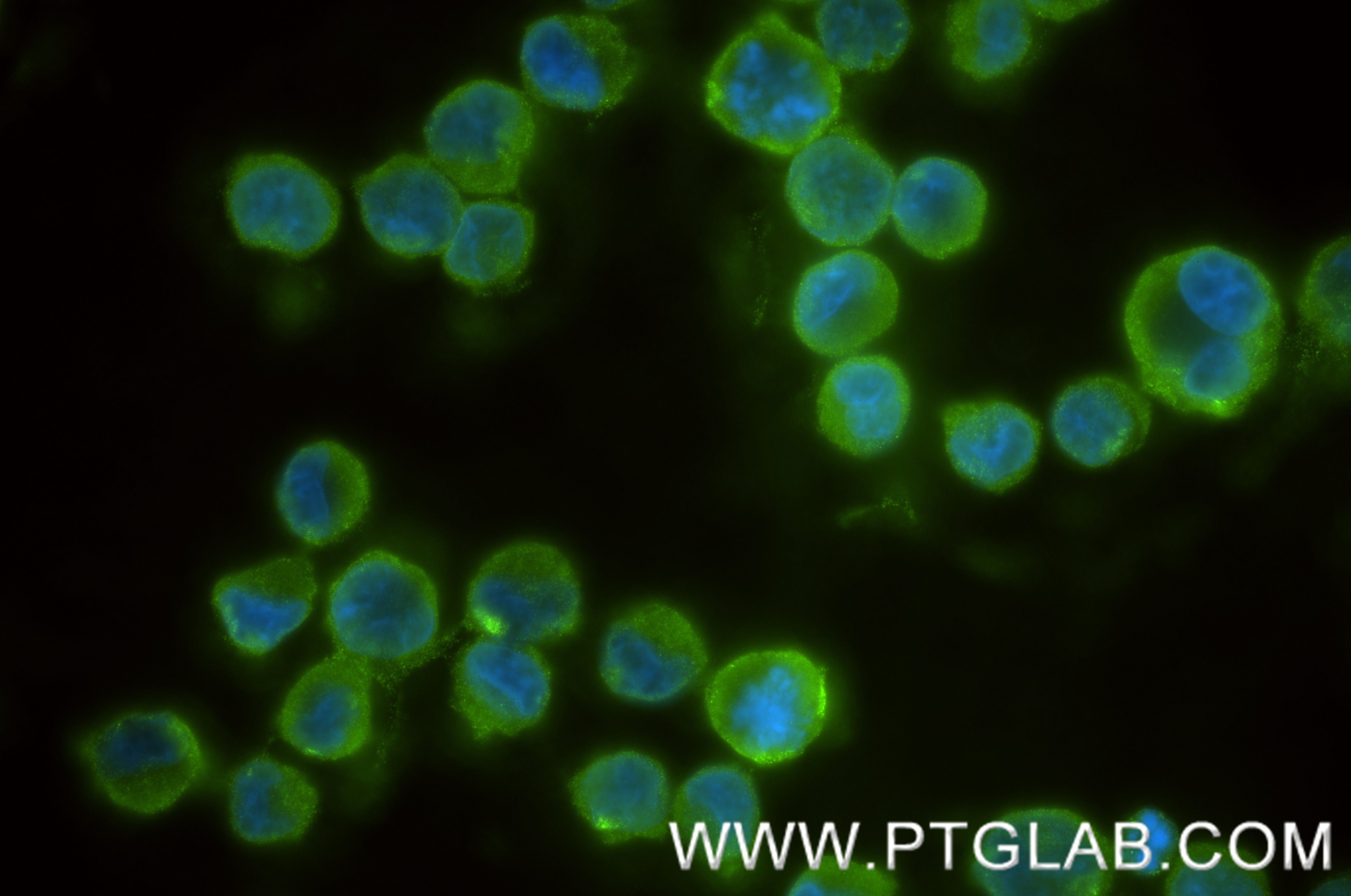 Immunofluorescence (IF) / fluorescent staining of K562 using RNF10 Recombinant antibody (86019-1-RR)