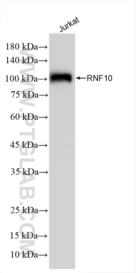 Western Blot (WB) analysis of Jurkat cells using RNF10 Recombinant antibody (86019-1-RR)