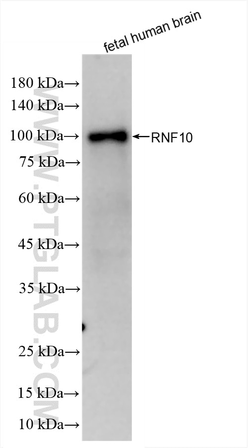 Western Blot (WB) analysis of fetal human brain tissue using RNF10 Recombinant antibody (86019-1-RR)