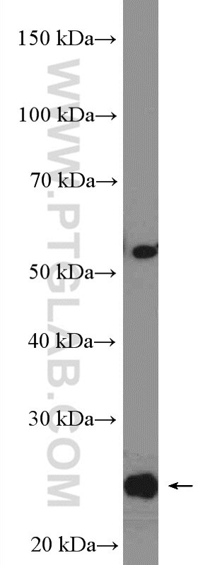 Western Blot (WB) analysis of mouse brain tissue using RNF11 Polyclonal antibody (16948-1-AP)