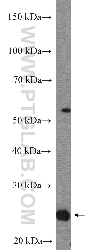 Western Blot (WB) analysis of mouse brain tissue using RNF11 Polyclonal antibody (16948-1-AP)