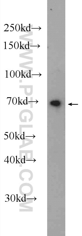 Western Blot (WB) analysis of mouse kidney tissue using RNF112 Polyclonal antibody (25165-1-AP)