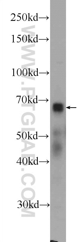 Western Blot (WB) analysis of HEK-293 cells using RNF112 Polyclonal antibody (25165-1-AP)