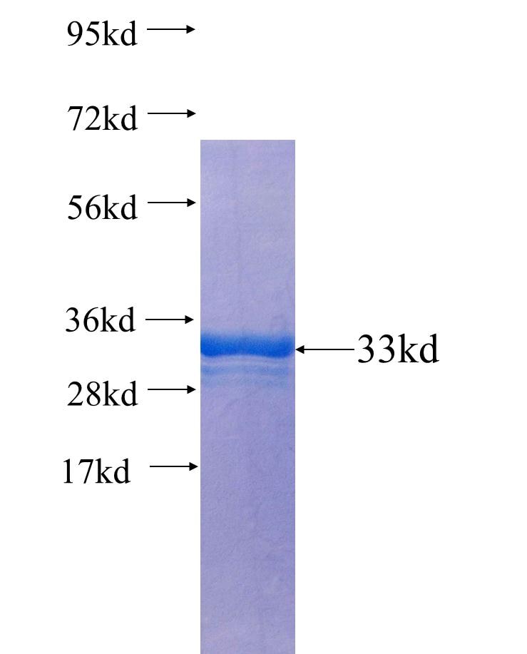 RNF113A fusion protein Ag25313 SDS-PAGE