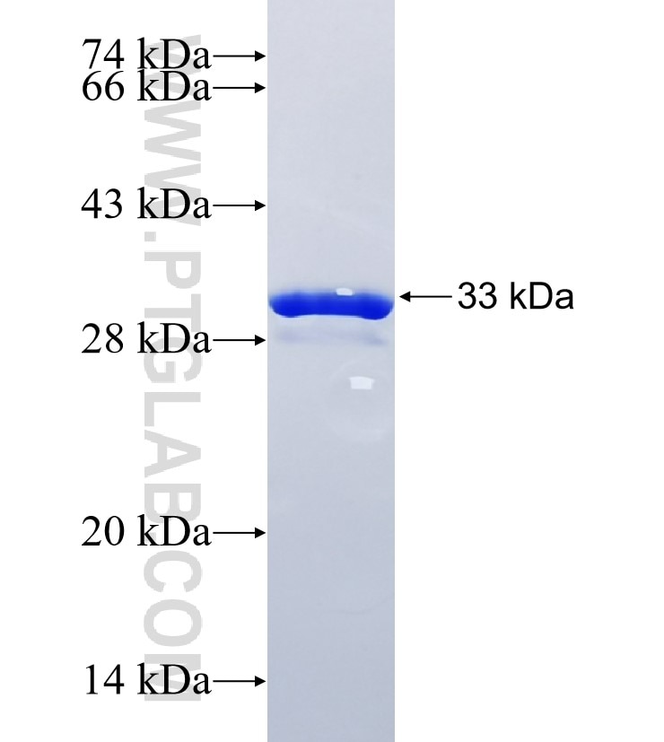 RNF113B fusion protein Ag22187 SDS-PAGE