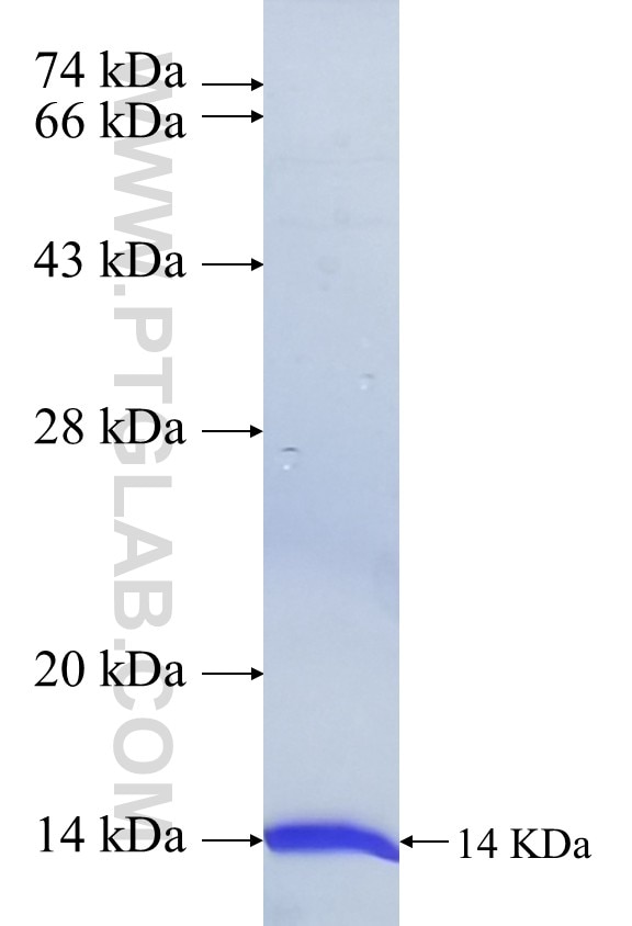 RNF113B fusion protein Ag39719 SDS-PAGE