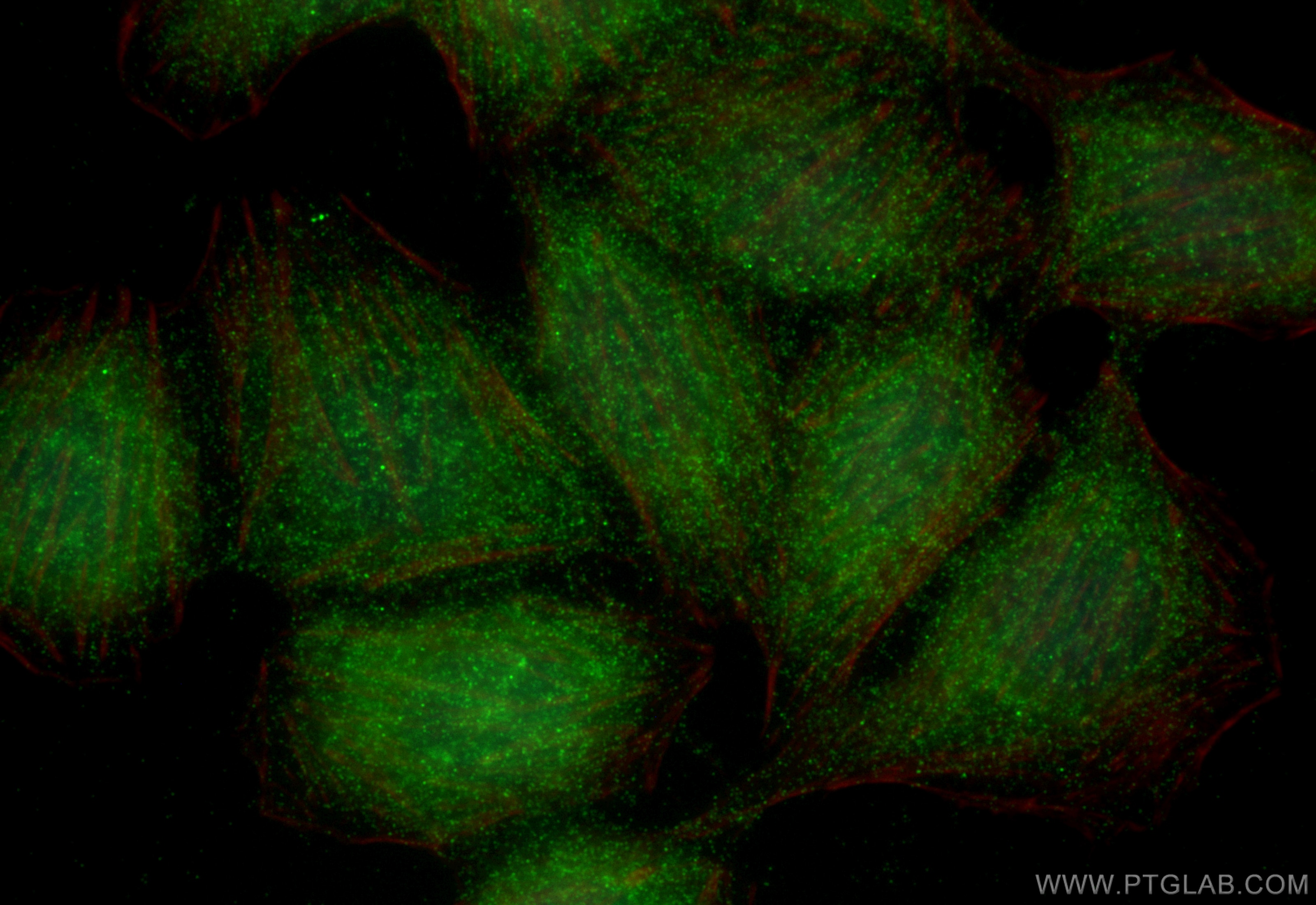 Immunofluorescence (IF) / fluorescent staining of BGC-823 cells using RNF114 Polyclonal antibody (14338-1-AP)