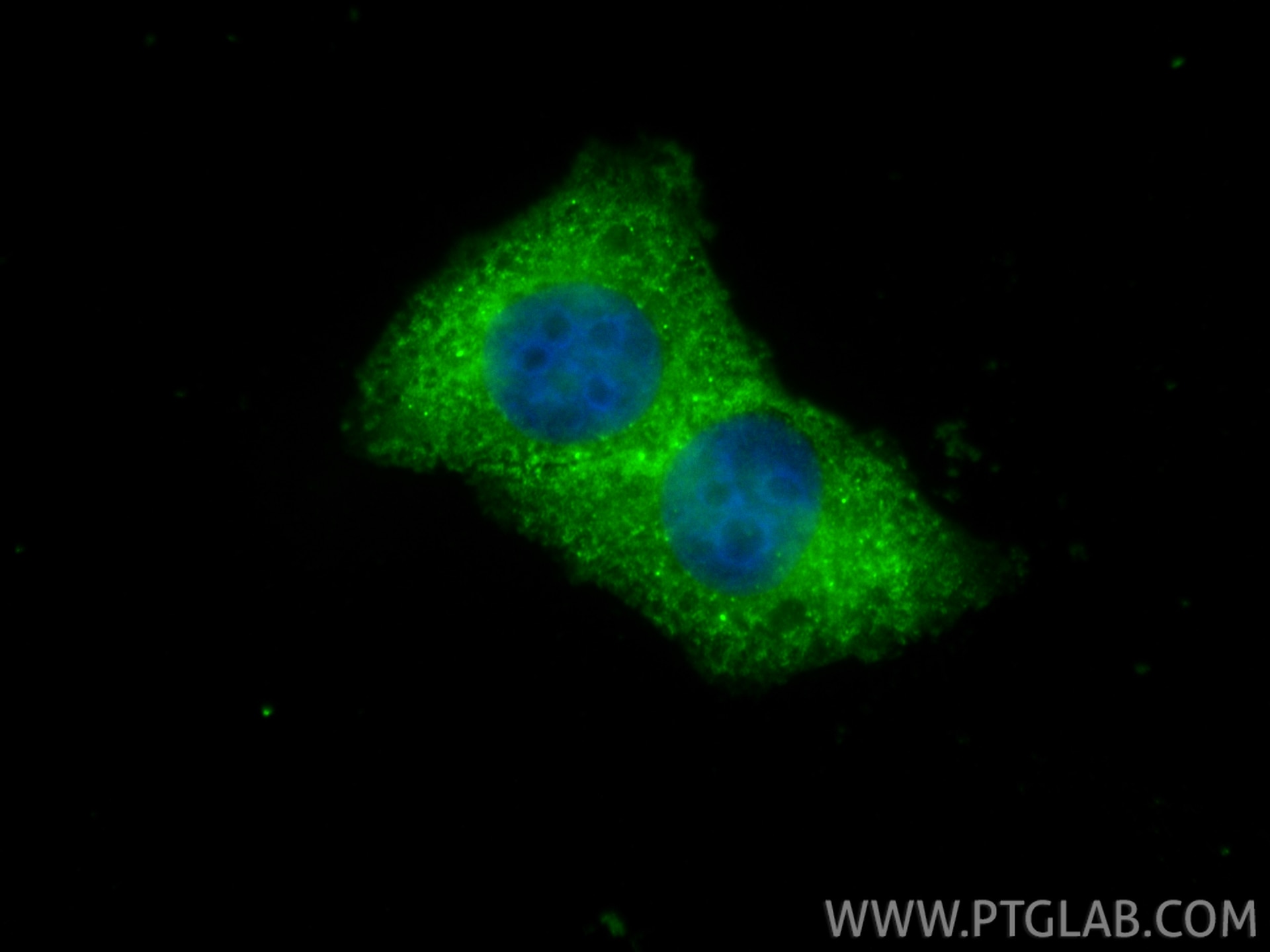 Immunofluorescence (IF) / fluorescent staining of BGC-823 cells using RNF114 Polyclonal antibody (14338-1-AP)