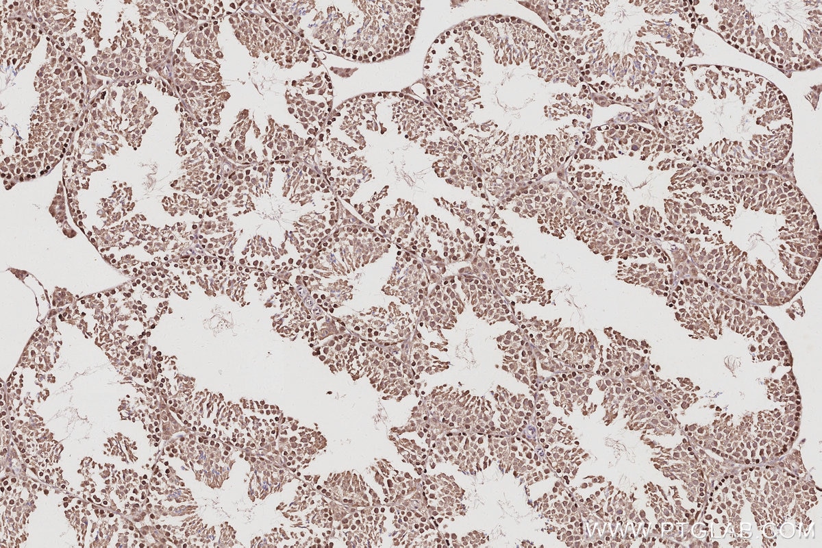 IHC staining of mouse testis using 14338-1-AP Immunohistochemistry (IHC) staining of mouse testis tissue using RNF114 Polyclonal antibody (14338-1-AP)