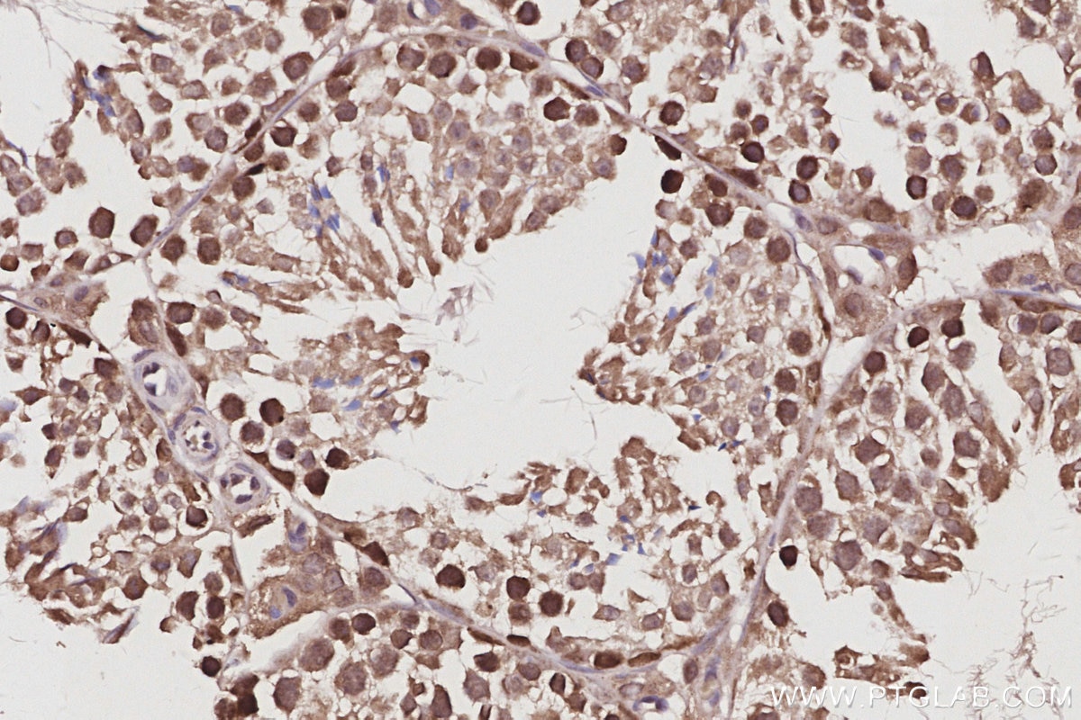 IHC staining of mouse testis using 14338-1-AP Immunohistochemistry (IHC) staining of mouse testis tissue using RNF114 Polyclonal antibody (14338-1-AP)