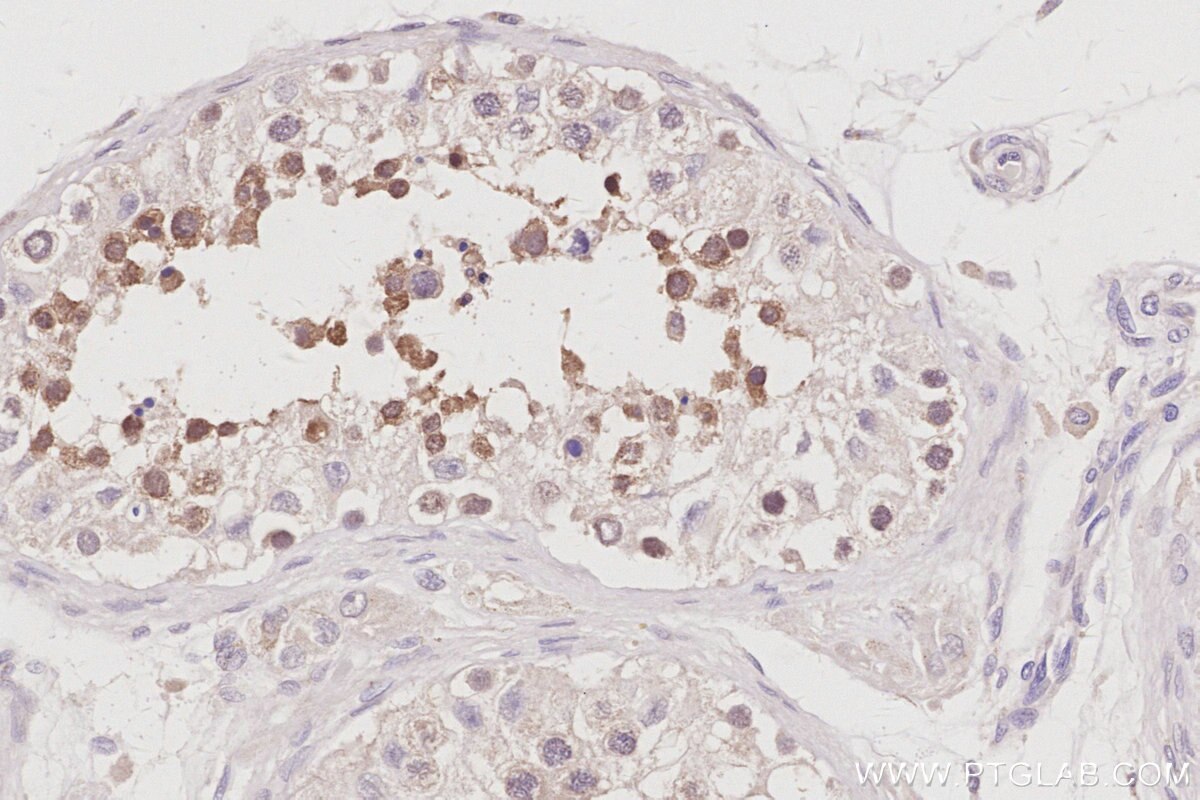 IHC staining of human testis using 14338-1-AP Immunohistochemistry (IHC) staining of human testis tissue using RNF114 Polyclonal antibody (14338-1-AP)