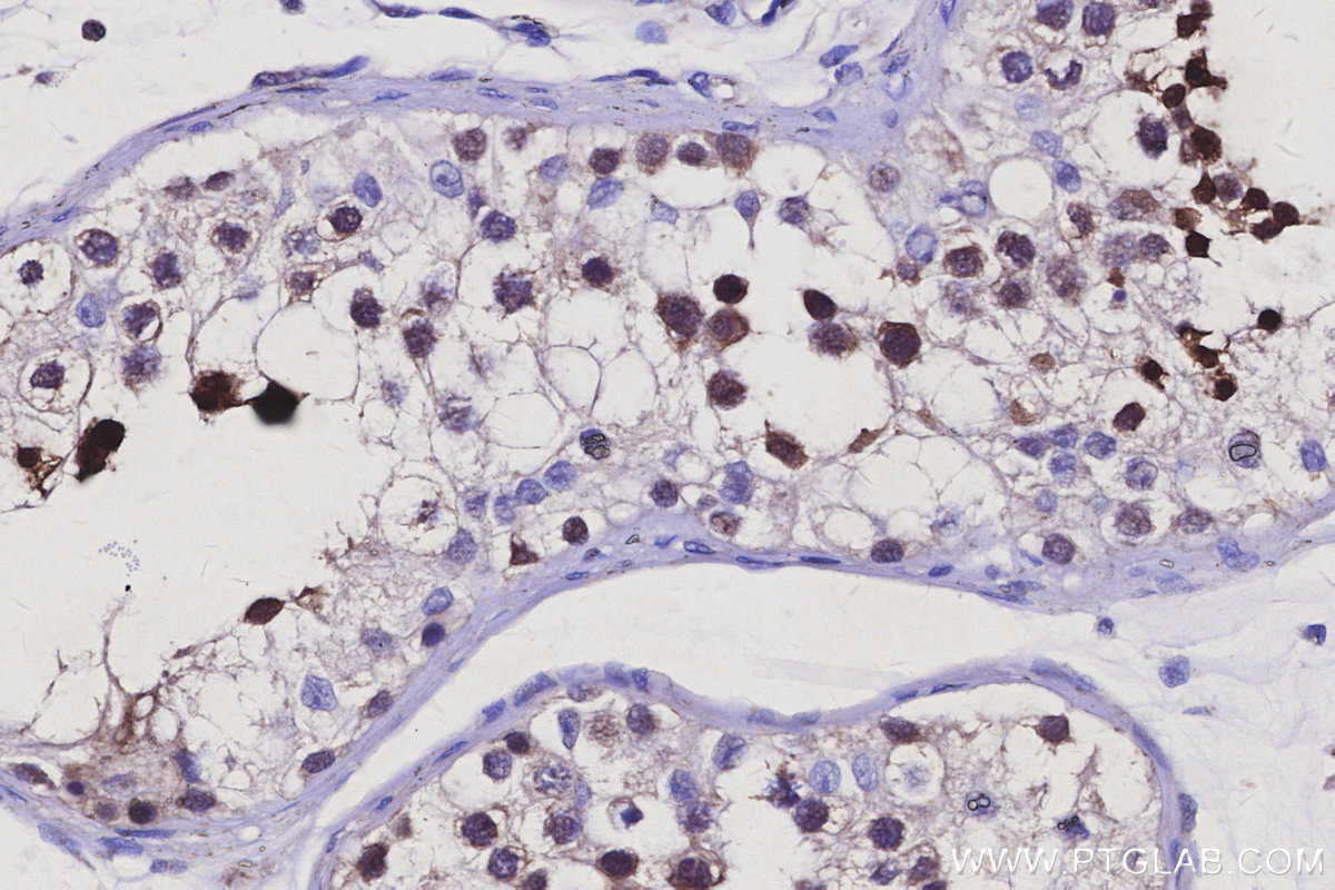 IHC staining of human testis using 14338-1-AP Immunohistochemistry (IHC) staining of human testis tissue using RNF114 Polyclonal antibody (14338-1-AP)