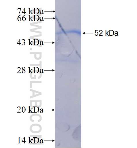 RNF114 fusion protein Ag5649 SDS-PAGE