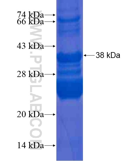 RNF115 fusion protein Ag20451 SDS-PAGE