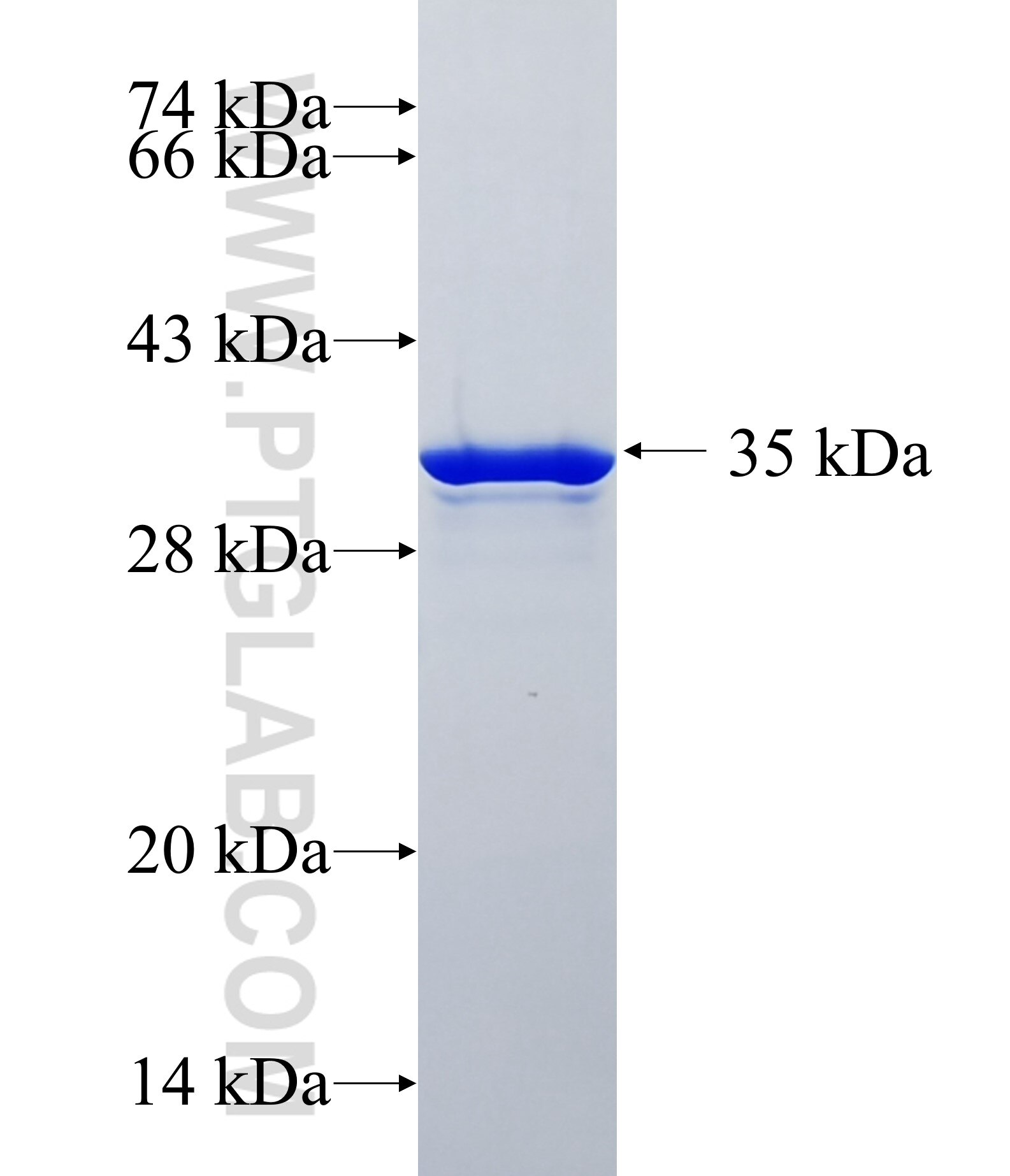 RNF121 fusion protein Ag18938 SDS-PAGE