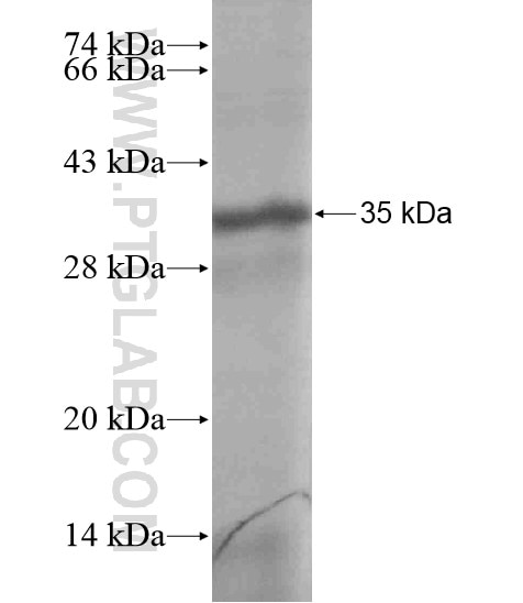RNF121 fusion protein Ag18938 SDS-PAGE
