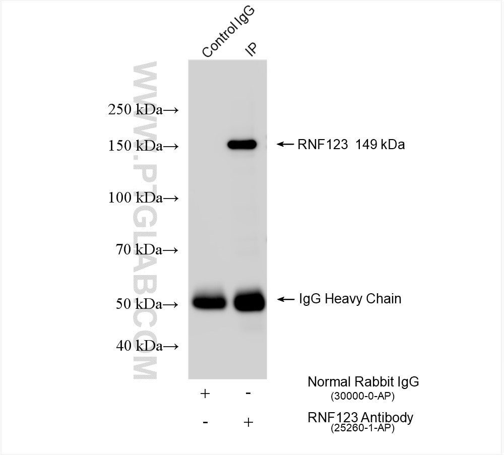 Immunoprecipitation (IP) experiment of HeLa cells using RNF123 Polyclonal antibody (25260-1-AP)