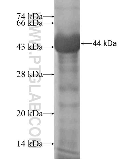 RNF123 fusion protein Ag19653 SDS-PAGE