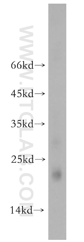 Western Blot (WB) analysis of A2780 cells using RNF125 Polyclonal antibody (13290-1-AP)