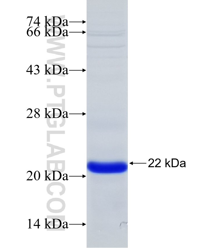 RNF125 fusion protein Ag31844 SDS-PAGE