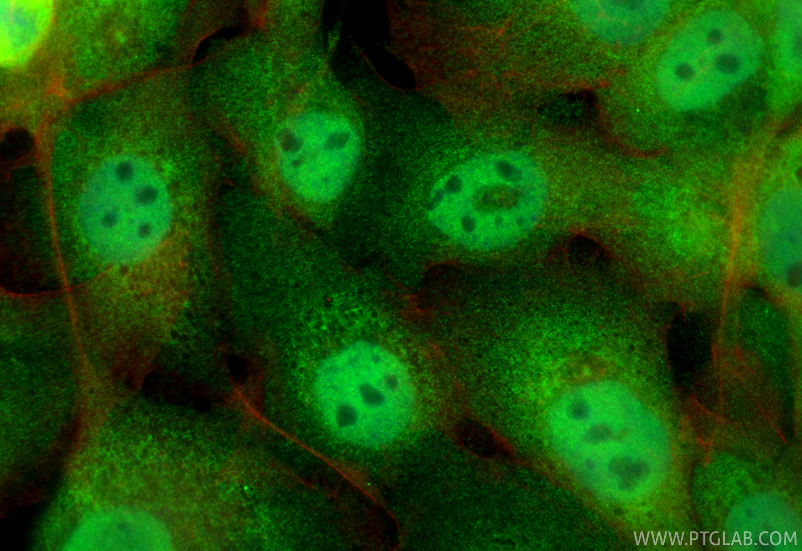 Immunofluorescence (IF) / fluorescent staining of A431 cells using RNF126 Polyclonal antibody (19835-1-AP)