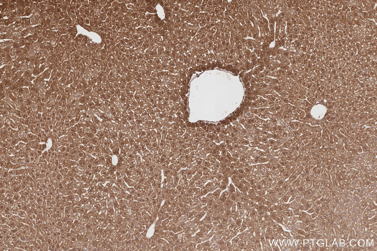 IHC staining of mouse liver using 19835-1-AP Immunohistochemistry (IHC) staining of mouse liver tissue using RNF126 Polyclonal antibody (19835-1-AP)