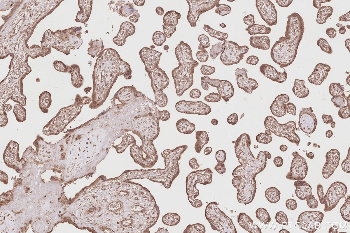 IHC staining of human placenta using 19835-1-AP Immunohistochemistry (IHC) staining of human placenta tissue using RNF126 Polyclonal antibody (19835-1-AP)