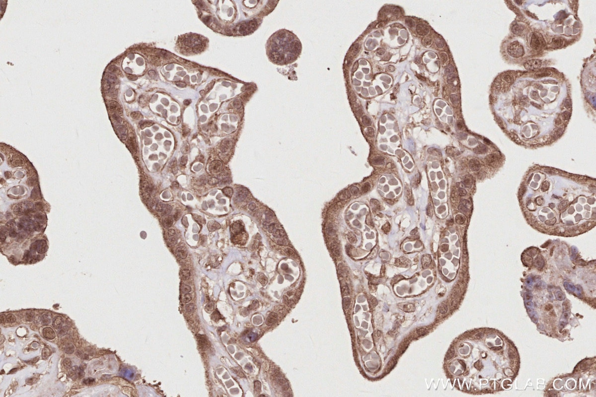 IHC staining of human placenta using 19835-1-AP Immunohistochemistry (IHC) staining of human placenta tissue using RNF126 Polyclonal antibody (19835-1-AP)
