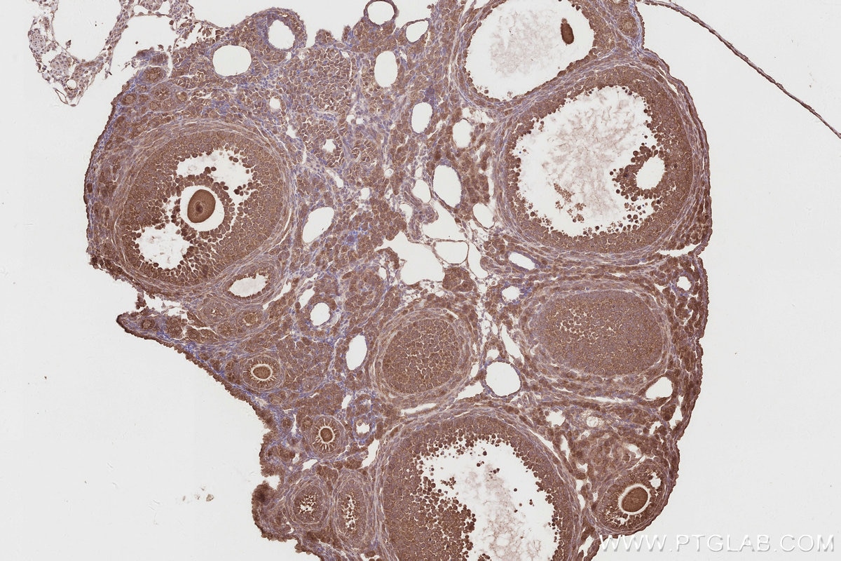 IHC staining of mouse ovary using 19835-1-AP Immunohistochemistry (IHC) staining of mouse ovary tissue using RNF126 Polyclonal antibody (19835-1-AP)