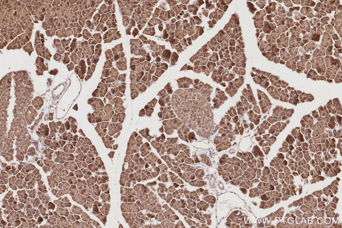 IHC staining of mouse pancreas using 19835-1-AP Immunohistochemistry (IHC) staining of mouse pancreas tissue using RNF126 Polyclonal antibody (19835-1-AP)