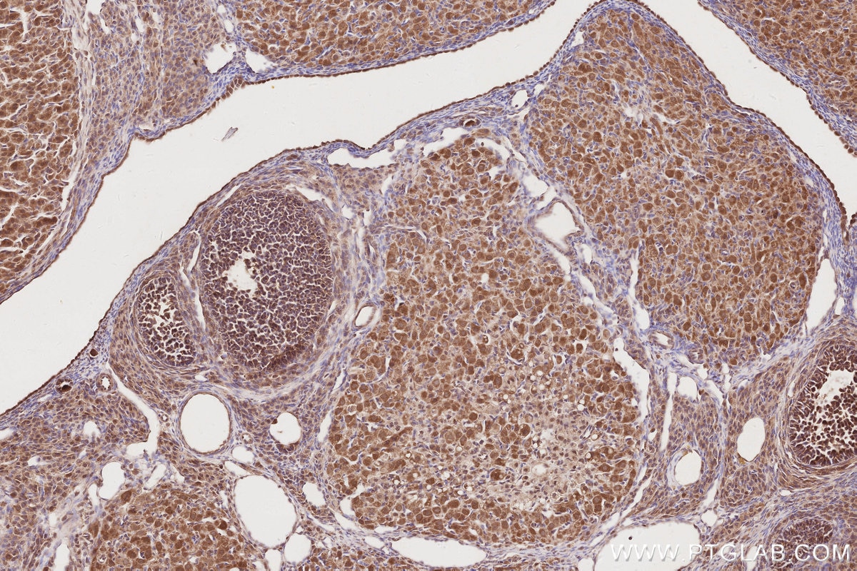 IHC staining of rat ovary using 19835-1-AP Immunohistochemistry (IHC) staining of rat ovary tissue using RNF126 Polyclonal antibody (19835-1-AP)