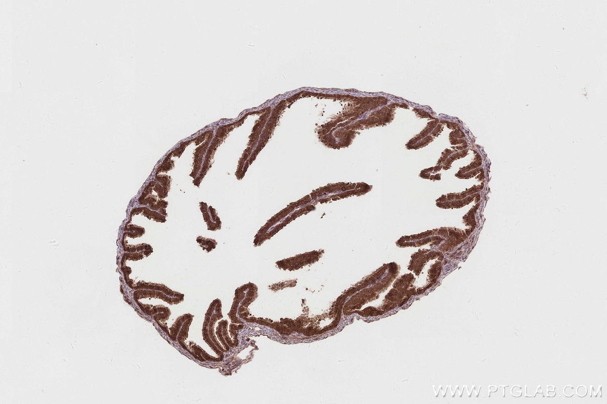 IHC staining of mouse ovary using 19835-1-AP Immunohistochemistry (IHC) staining of mouse ovary tissue using RNF126 Polyclonal antibody (19835-1-AP)
