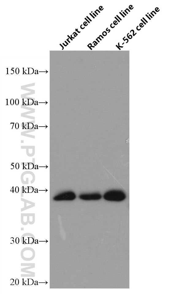 Western Blot (WB) analysis of Jurkat cells using RNF126 Monoclonal antibody (66647-1-Ig)
