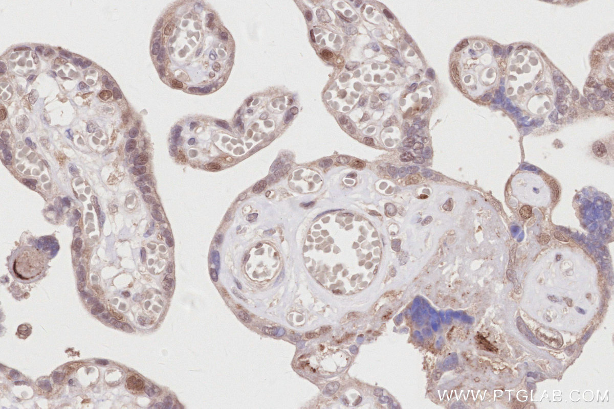 Immunohistochemistry (IHC) staining of human placenta tissue using RNF126 Recombinant antibody (84772-6-RR)