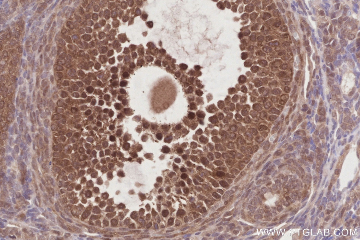Immunohistochemistry (IHC) staining of mouse ovary tissue using RNF126 Recombinant antibody (84772-6-RR)