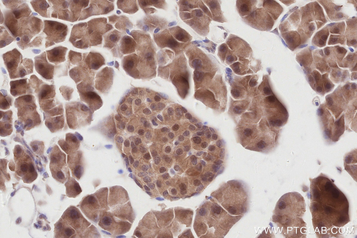 Immunohistochemistry (IHC) staining of mouse pancreas tissue using RNF126 Recombinant antibody (84772-6-RR)