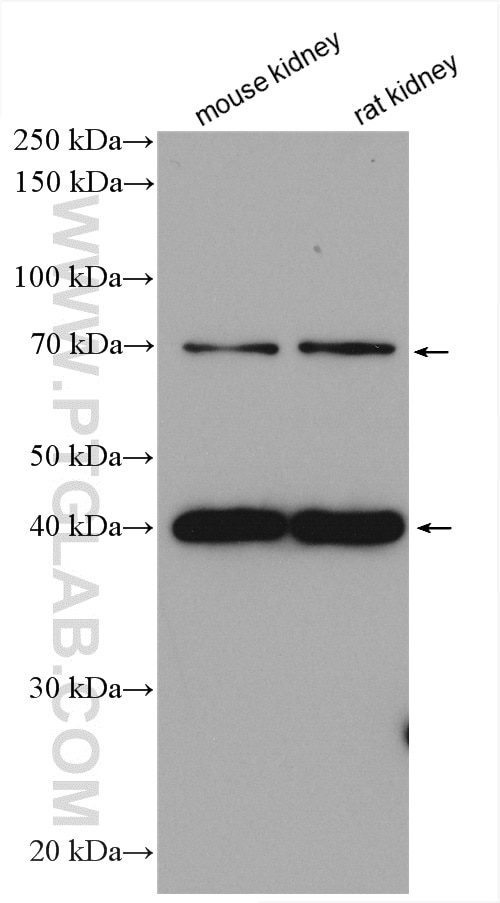 Western Blot (WB) analysis of various lysates using RNF128 Polyclonal antibody (26015-1-AP)