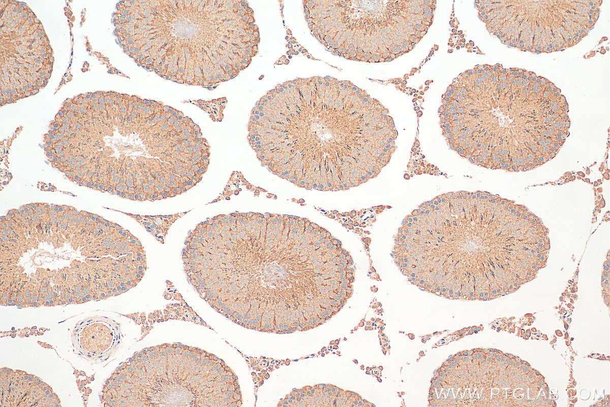 Immunohistochemistry (IHC) staining of rat testis tissue using RNF133 Polyclonal antibody (20792-1-AP)