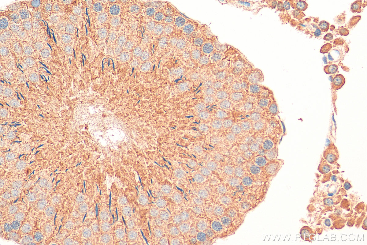 Immunohistochemistry (IHC) staining of rat testis tissue using RNF133 Polyclonal antibody (20792-1-AP)