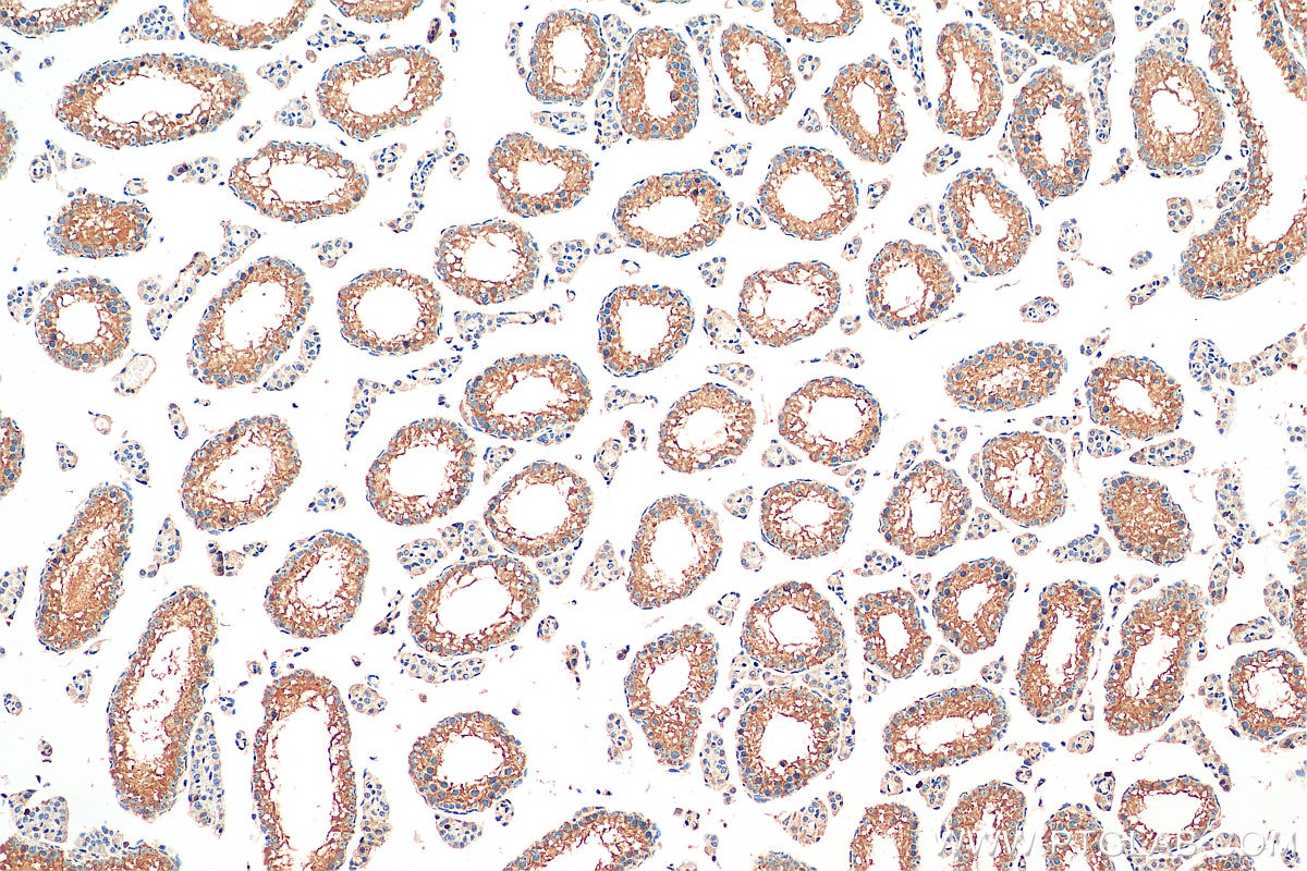 Immunohistochemistry (IHC) staining of mouse testis tissue using RNF133 Polyclonal antibody (20792-1-AP)