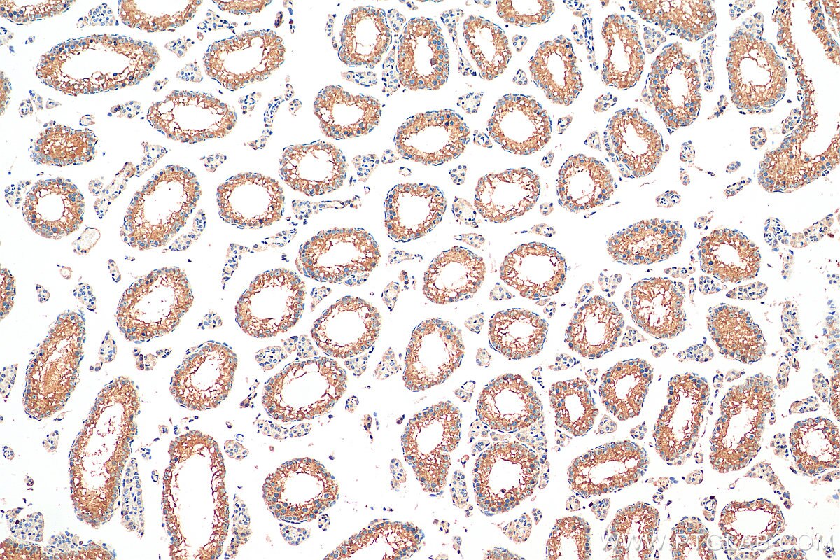 Immunohistochemistry (IHC) staining of mouse testis tissue using RNF133 Polyclonal antibody (20792-1-AP)