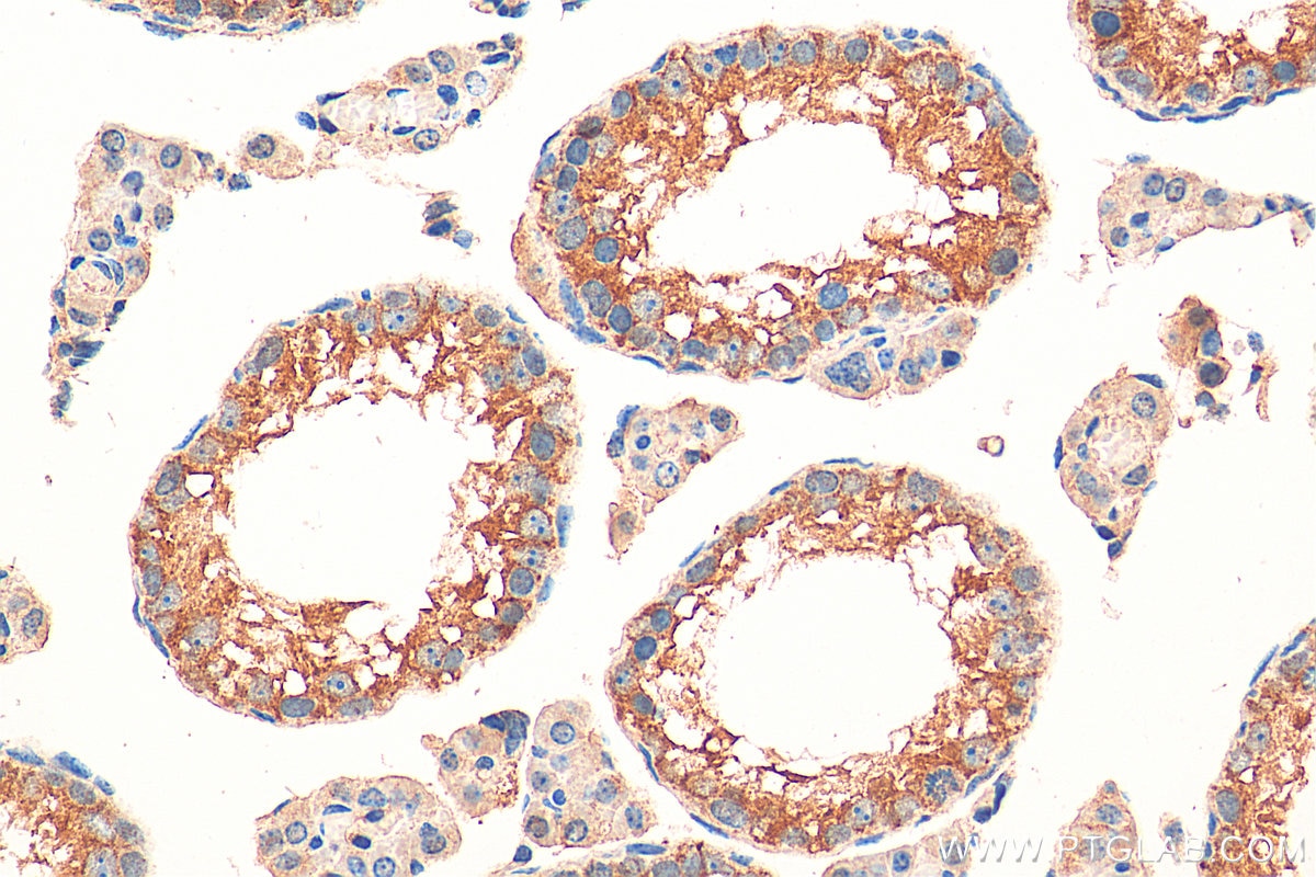 Immunohistochemistry (IHC) staining of mouse testis tissue using RNF133 Polyclonal antibody (20792-1-AP)