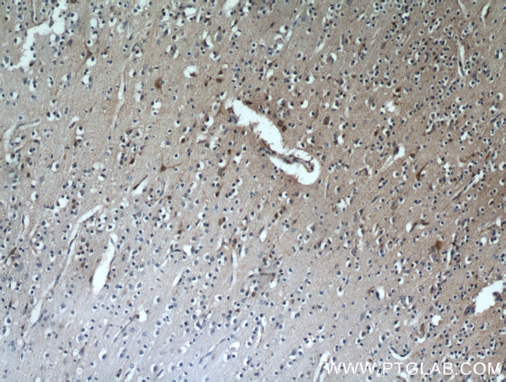 Immunohistochemistry (IHC) staining of human brain tissue using RNF133 Polyclonal antibody (20792-1-AP)