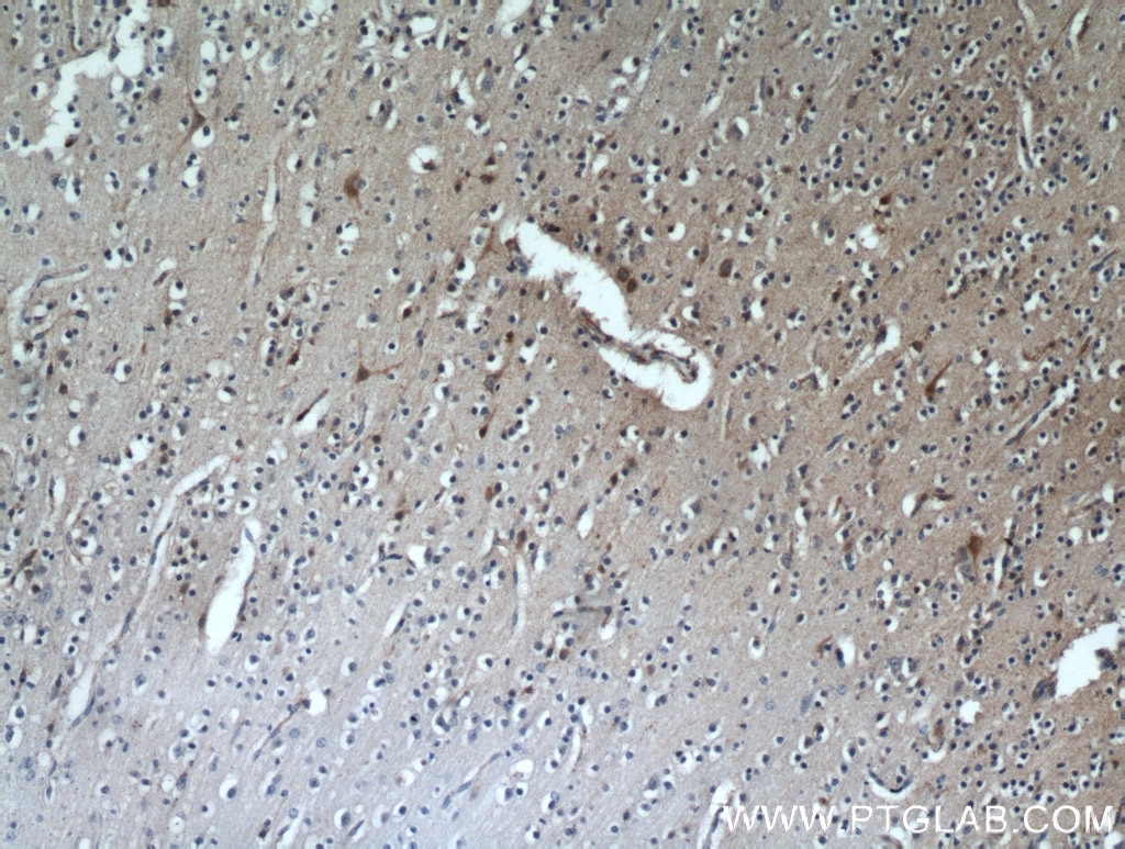 Immunohistochemistry (IHC) staining of human brain tissue using RNF133 Polyclonal antibody (20792-1-AP)