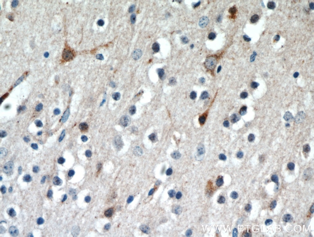 Immunohistochemistry (IHC) staining of human brain tissue using RNF133 Polyclonal antibody (20792-1-AP)