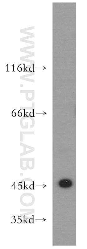 Western Blot (WB) analysis of HeLa cells using RNF133 Polyclonal antibody (20792-1-AP)