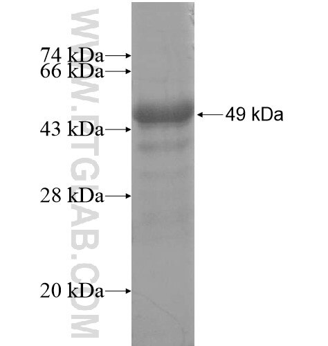 RNF133 fusion protein Ag14537 SDS-PAGE