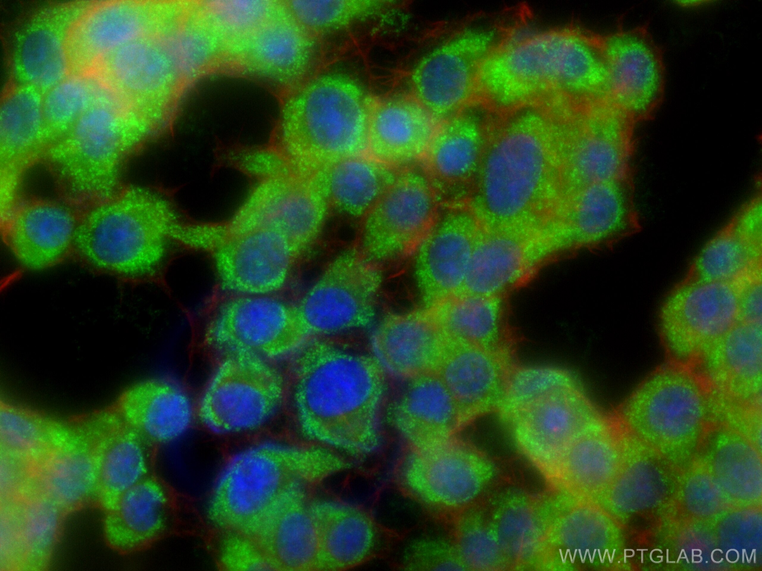 Immunofluorescence (IF) / fluorescent staining of PC-12 cells using RNF135 Polyclonal antibody (25061-1-AP)