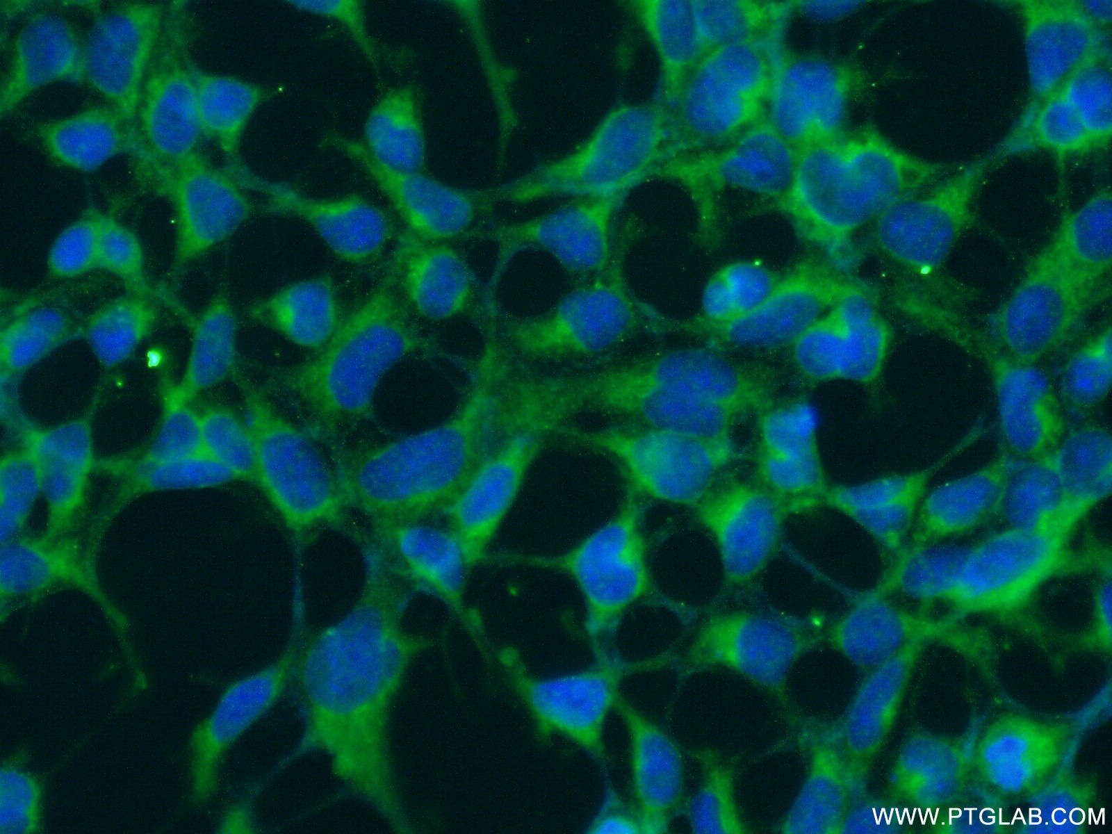 Immunofluorescence (IF) / fluorescent staining of HEK-293 cells using RNF135 Polyclonal antibody (25061-1-AP)